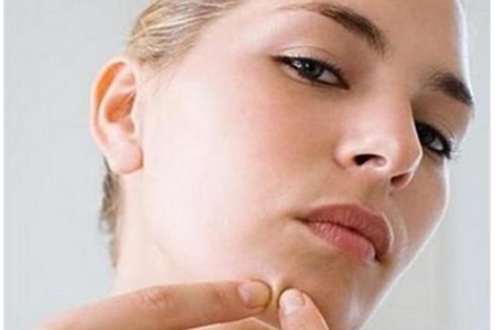 皮肤下巴长痘是激素失踪调，女性调剂月经的四个体例