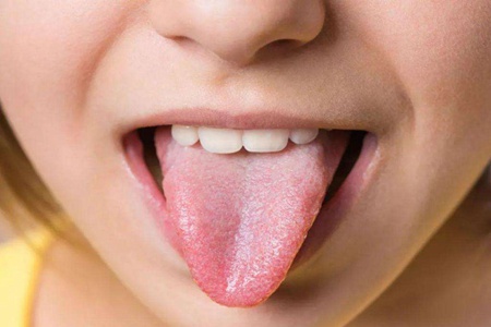 舌苔发白是什么原因，女性吃这六种食物可调剂