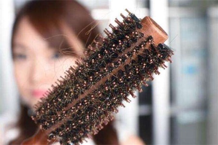 脱发是什么原因引起的？女性患有脂溢性脱发这样做可改善