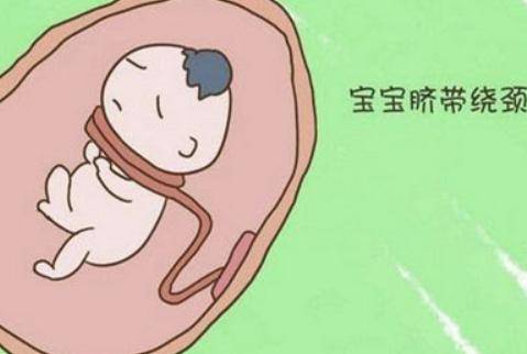 怀孕中期宝宝脐带绕颈总觉得喘，孕妈该怎么做？