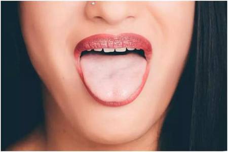 舌苔发黄是什么原因，六个不同症状判断病因对症下药