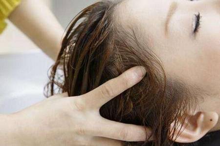 头发掉的厉害是什么原因怎么治疗   女性脂溢性脱发有哪些症状