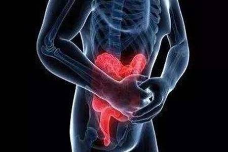 慢性结肠炎的症状有哪些  慢性结肠炎吃什么药效果最好