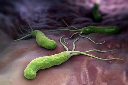 幽门螺旋杆菌是什么原因引起的？幽门螺旋杆菌最好的治疗方法