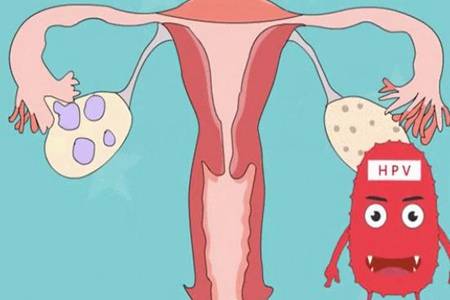 宫颈癌是什么如何预防 女子孕后查出宫颈癌顺利产子详情深扒
