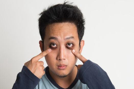 黑眼圈很严重是身体哪里出问题了？这四个原因可能是严重疾病征兆