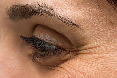 怎样去除眼角细纹？这四个方法轻松消除减龄效果