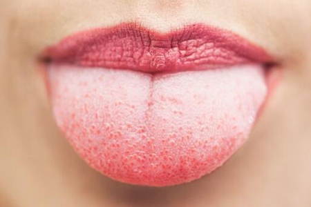 舌头发麻是什么原因？这四个原因导致别视而不见