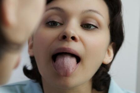 舌癌的早期症状？这五个症状及时治疗改善