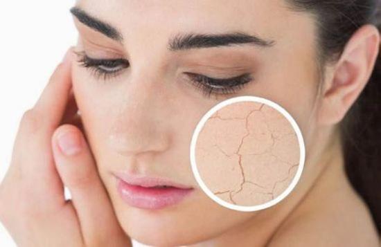 脸上干燥脱皮如何快速补救：3种方法帮助你