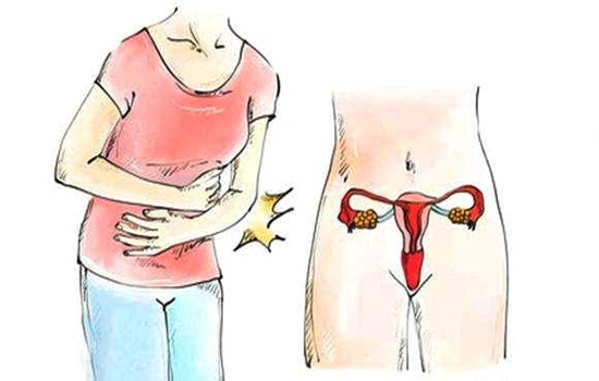 子宫内膜异位症的症状和危害