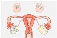月经量少是什么原因，女性不可忽视的妇科疾病