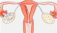 子宫内膜薄怎么调理恢复快一点 女性须知是什么原因造成