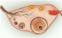 多囊卵巢综合症有什么症状表现 患有多囊卵巢可以受孕吗？