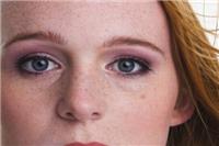 脸上长斑是因为什么原因引起的？这五个因素要改善治疗好