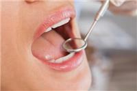 嘴巴苦是怎么回事？这五个因素造成需尽快对症下药