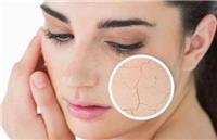 脸上干燥脱皮如何快速补救：3种方法帮助你